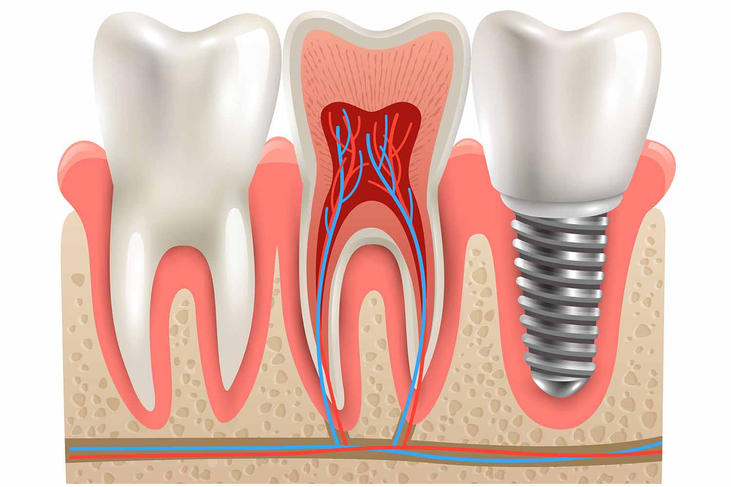 Oral Implantology