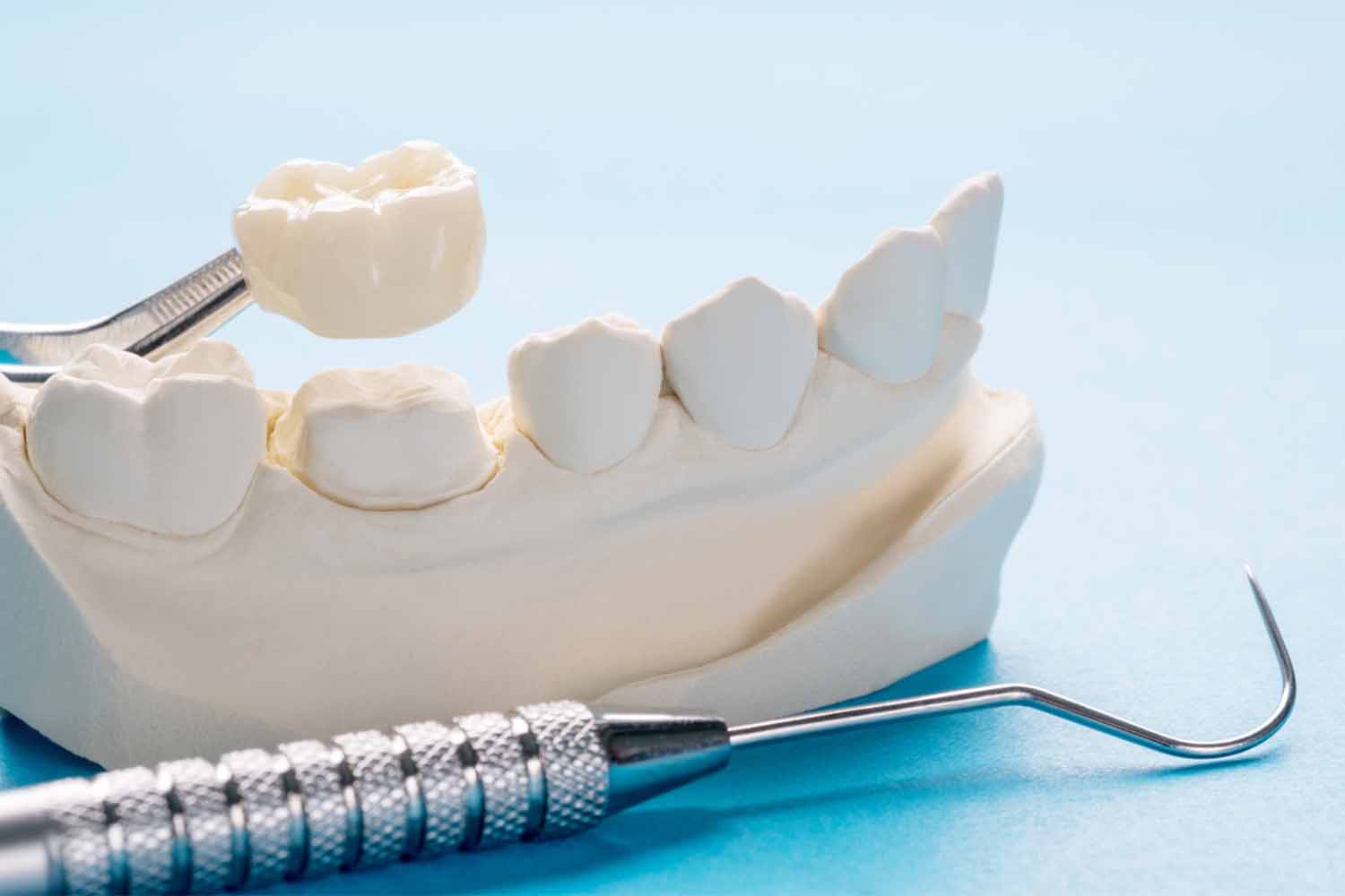 Prosthodontics